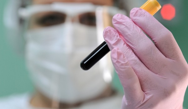 Штаб: За сутки в РФ госпитализировали 4 тыс. 540 человек с коронавирусной инфекцией