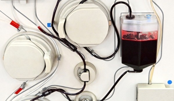 Более 30 тыс. литров донорской крови заготовили в Подмосковье с начала года
