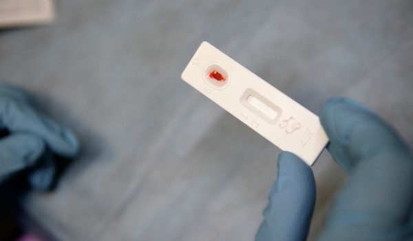 Горожанам предложили бесплатно сдать тест на ВИЧ в клиниках Роспотребнадзора