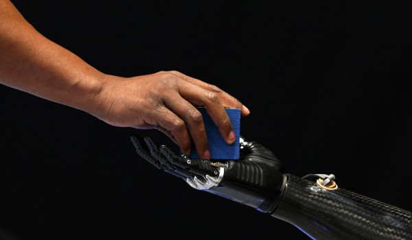 Собянин: Нацпроект помог на 20% увеличить выпуск бионических протезов