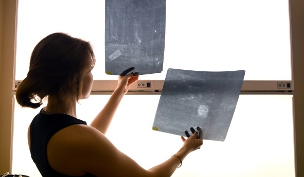 ИИ научили диагностировать туберкулез на рентгеновских снимках